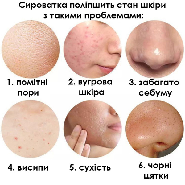 Сыворотка для лица SERSANLOVE Cactus Essence 30 мл с экстрактом кактуса